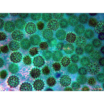 AmScope IN300 Series Inverted Phase-Contrast Biological Trinocular Compound Microscope with 30W Halogen and Optional Digital Camera